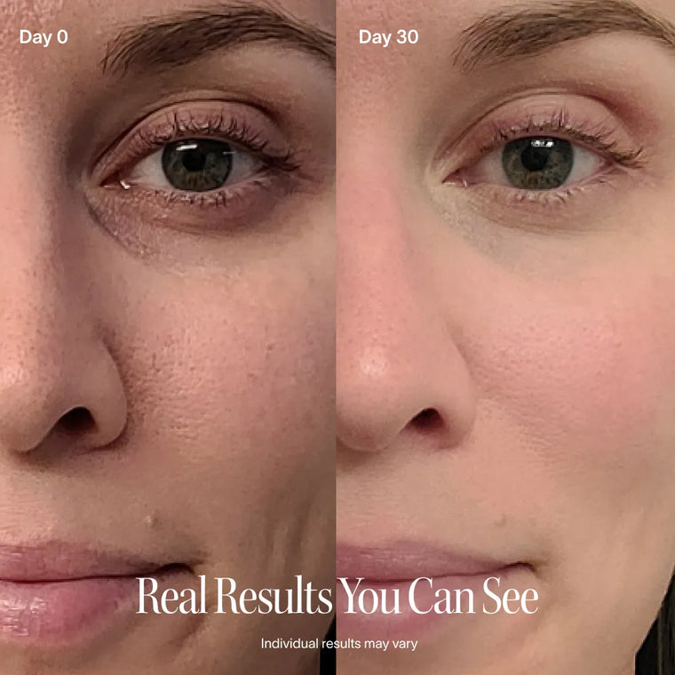 4-in-1 Skincare Wand